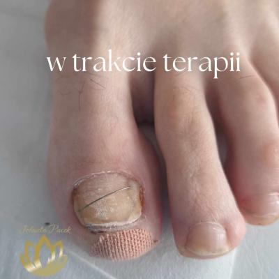 Fb Img 1741202255150