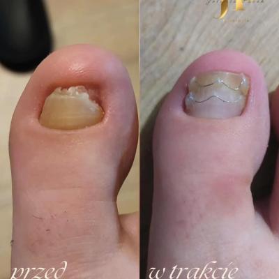 Fb Img 1741202527330