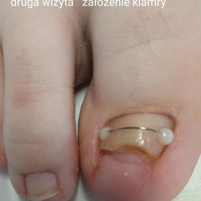 Fb Img 1741203518478