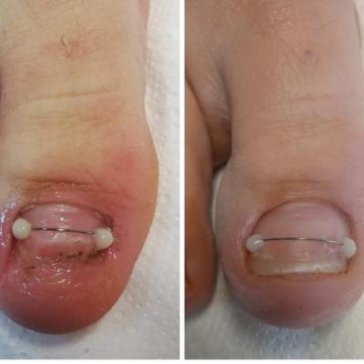 Fb Img 1741203593115